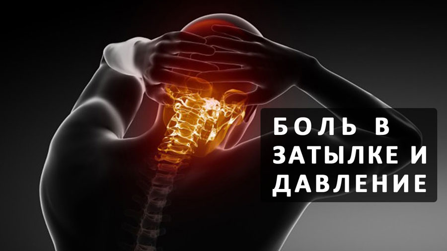 Сильно болит голова в затылке что выпить