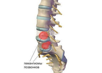 Болит спина долго стою хожу не болит