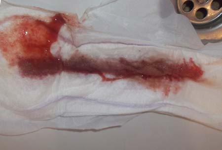 что не так патология