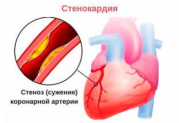 При наклоне головы болит спина и при дыхании