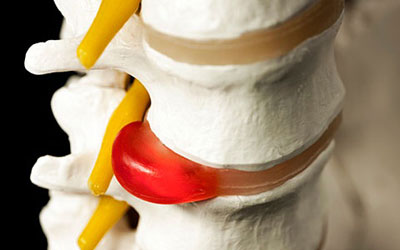 Заболевания сердца от которого болит спина