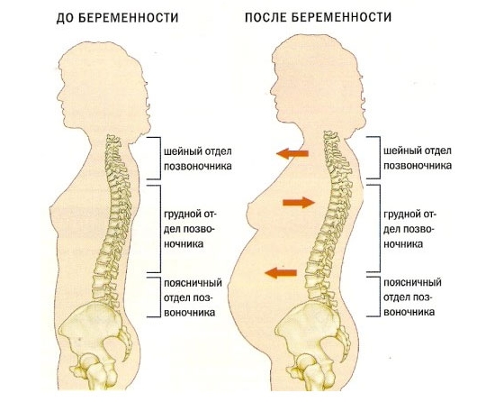 Нагрузка на позвоночник при беременности
