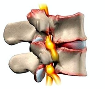 Заболевания сердца от которого болит спина