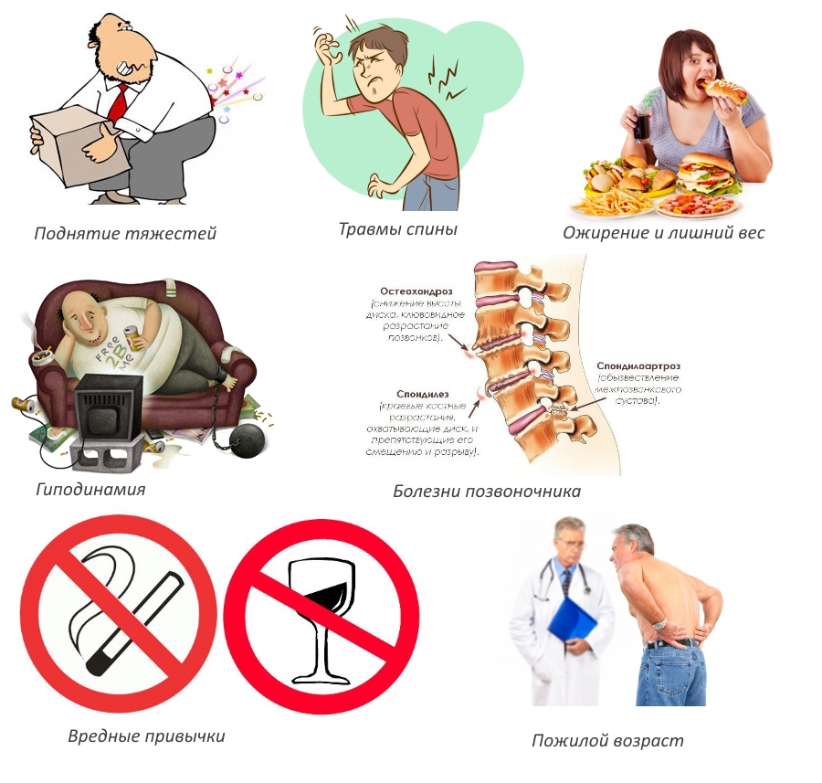 Причины грыжи поясничного отдела Причины грыжи поясничного отдела