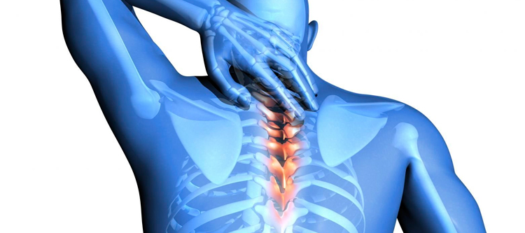 Поражение позвонков и межпозвоночных дисков нередко является причиной сдавливания лимфатических сосудов, что приводит к застою лимфы и развитию воспаления в лимфоузлах