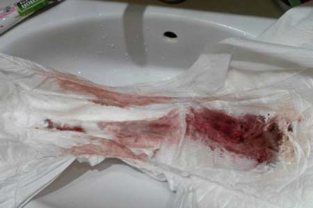 немного отличия