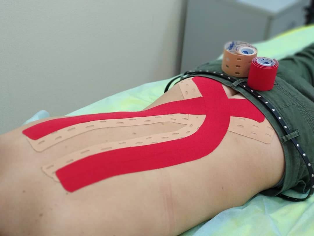 Медикаментозное лечение горба