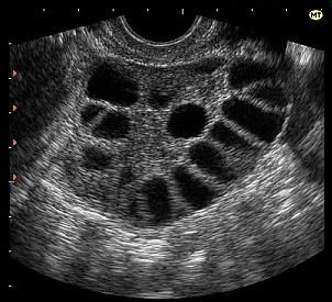 У меня болит спина после месячных