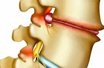 При наклоне головы болит спина и при дыхании